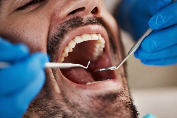 Best Cracked Tooth Emergency Dentist  in Burnettown, SC